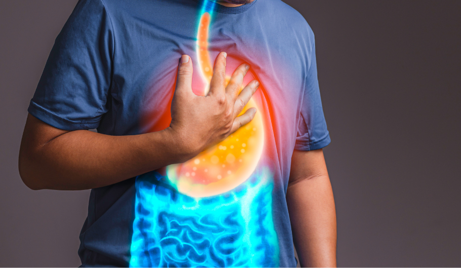 Cosa fare in caso di reflusso gastroesofageo Cosa fare in caso di reflusso gastroesofageo