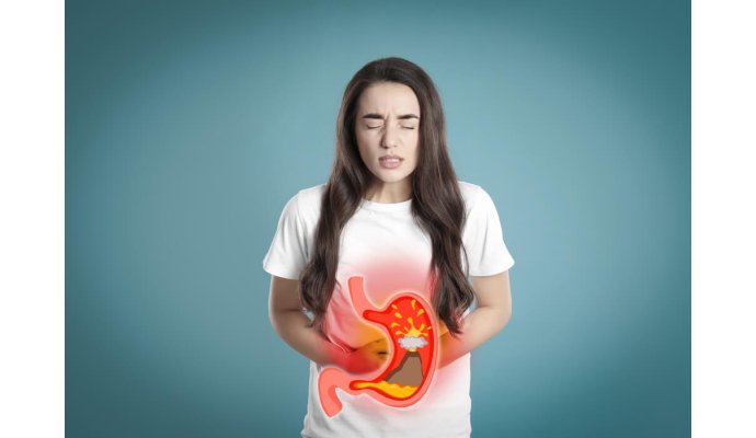 Bruciore di stomaco e acidità gastrica: cause, sintomi e rimedi Bruciore di stomaco e acidità gastrica: cause, sintomi e rimedi