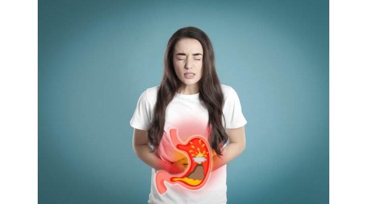 Bruciore di stomaco e acidità gastrica: cause, sintomi e rimedi Bruciore di stomaco e acidità gastrica: cause, sintomi e rimedi