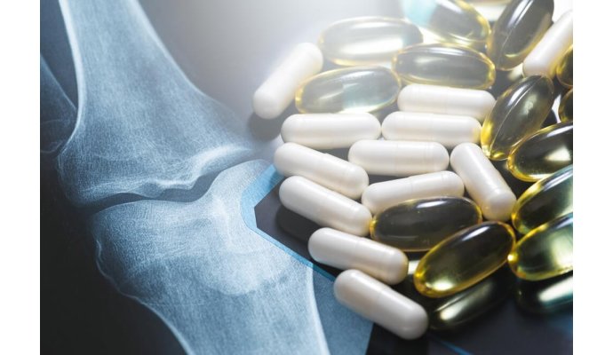 Cos'è la glucosamina e come usarla per ridurre il dolore alle articolazioni Cos'è la glucosamina e come usarla per ridurre il dolore alle articolazioni